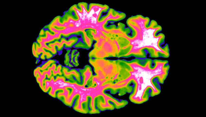 Colourful picture of a horizontal "slice" of brain